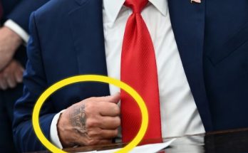 Donald Trump at event showing leg swelling