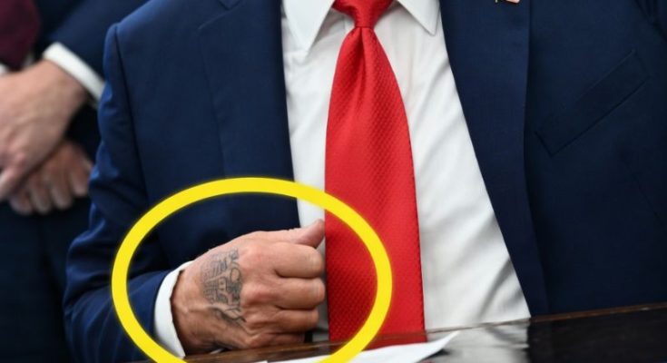 Donald Trump at event showing leg swelling